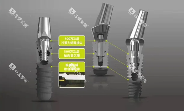 百康特种植牙怎么样