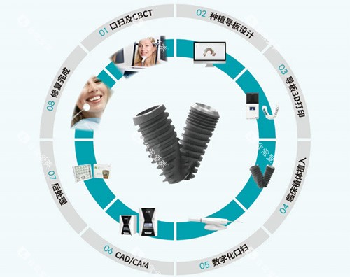 沃兰种植牙全部流程图