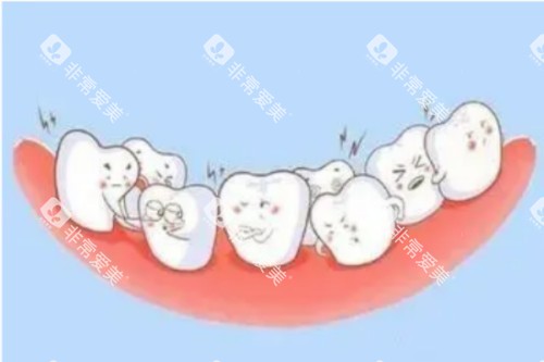 牙齿畸形卡通图 牙齿畸形卡通图