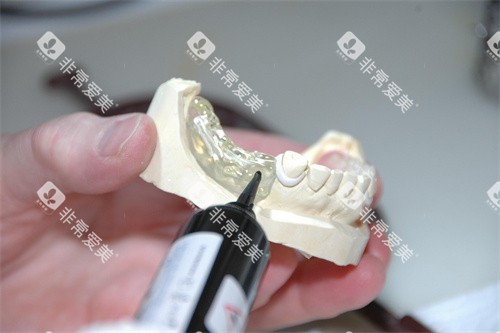 牙齿修复示意图宣传 牙齿修复示意图宣传