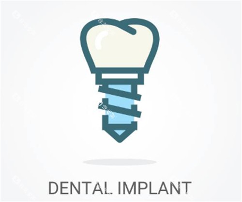 种植牙线条示意图