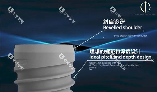 韩一种植牙优势