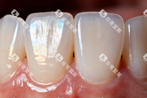 健康正常牙齿卡通图