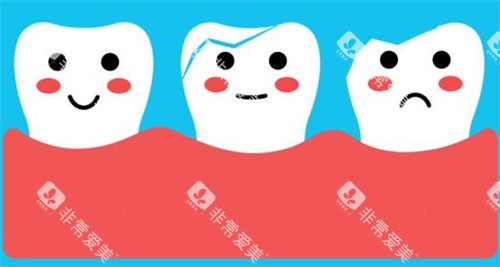 牙齿萌萌图