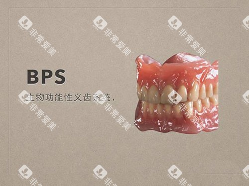 牙齿义齿吸附性义齿示意图