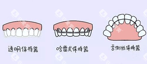 牙齿矫正正畸保持器漫画图