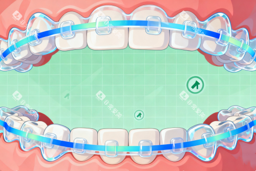 牙齿矫正卡通图片展示 牙齿矫正卡通图片展示