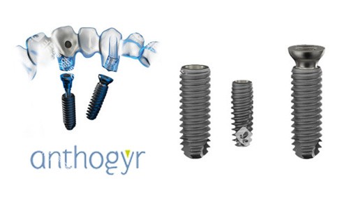 安卓健种植牙修复