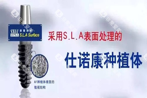 仕诺康种植牙宣传