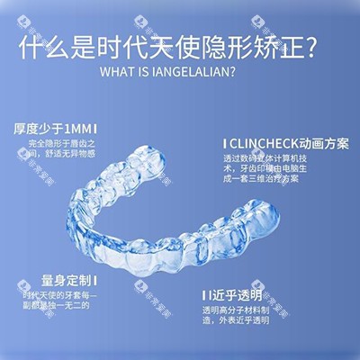 时代天使优势特色有哪些