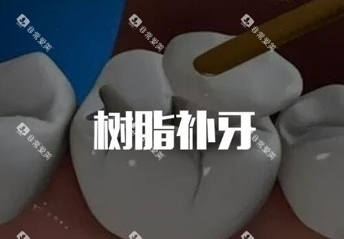 树脂补牙卡通 树脂补牙卡通