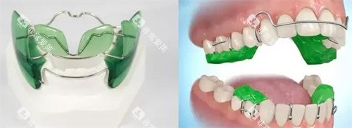 MRC如何佩戴 MRC如何佩戴