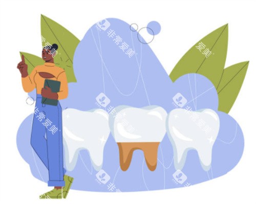 种植牙模拟图 种植牙模拟图