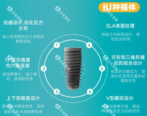 沃兰IU型号种植牙