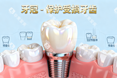 种植牙植入卡通一览