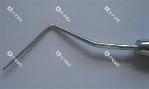 牙周探针是什么