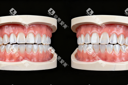 牙齿模型展示图