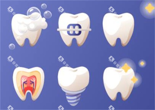 牙齿的各个项目
