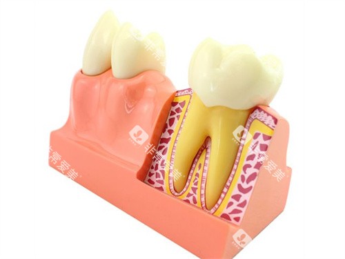 牙齿解剖模型 牙齿解剖模型