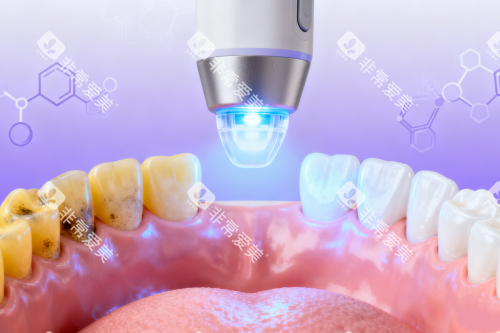 牙齿美白修复卡通展示图