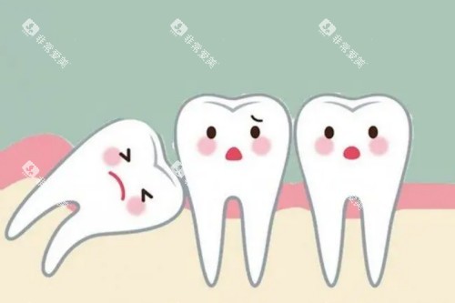 智齿图片一览 智齿图片一览