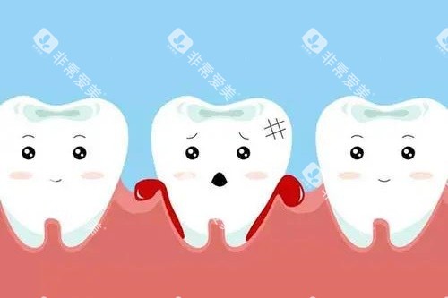 牙龈出血卡通图 牙龈出血卡通图