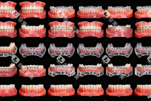 牙齿矫正步骤图一览