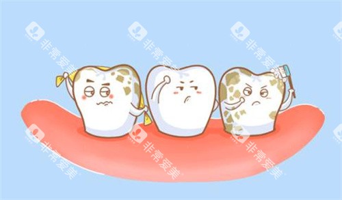 氟斑牙怎么办卡通图 氟斑牙怎么办卡通图