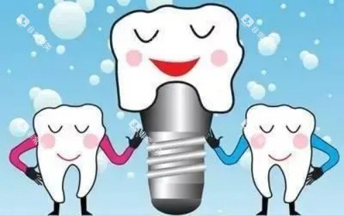 牙齿种植体示意图 牙齿种植体示意图