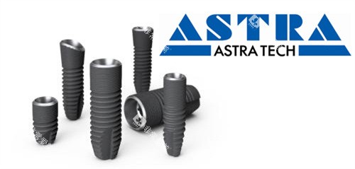 AstraTech种植牙 AstraTech种植牙