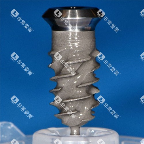 瑞士士卓曼iti种植牙瑞锆系列