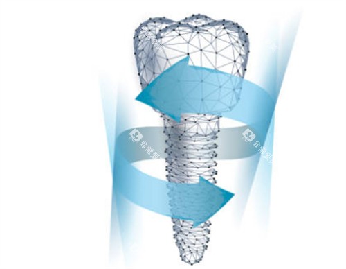 种植牙模型卡通图