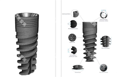 以色列丹特因种植体