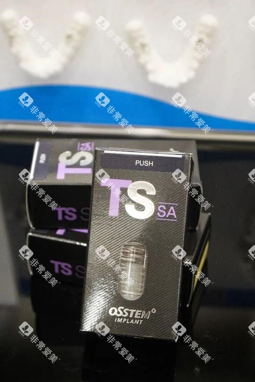 奥齿泰TS种植牙