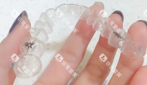 时代天使牙套照片