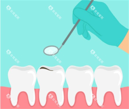 牙齿检查卡通图片