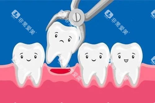 牙齿拔除卡通示意图