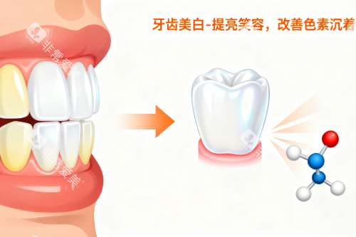 牙齿美白卡通图片一览 牙齿美白卡通图片一览