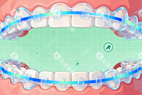 牙齿矫正卡通图片展示