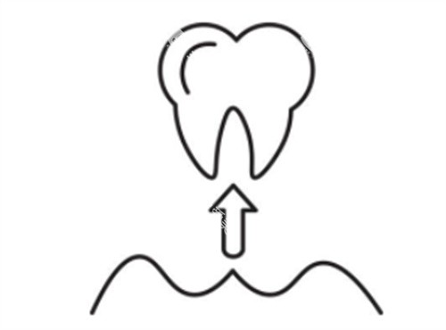 把牙齿拔出来 把牙齿拔出来