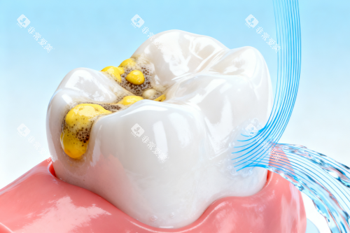 牙齿清洁卡通图 牙齿清洁卡通图