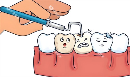 补牙手术项目动画