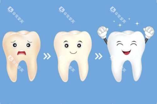 牙齿美白顺序图 牙齿美白顺序图