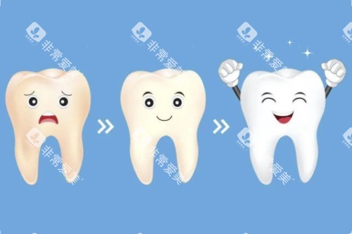 牙齿美白顺序图 牙齿美白顺序图