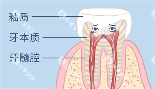 牙齿变黄怎么办 牙齿变黄怎么办