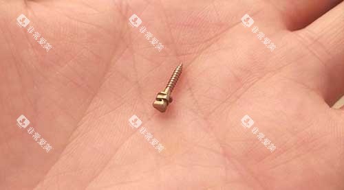 牙齿矫正骨钉种植钉3 牙齿矫正骨钉种植钉3