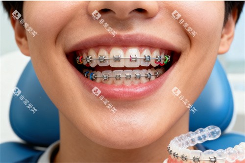 儿童牙齿矫正图片 儿童牙齿矫正图片