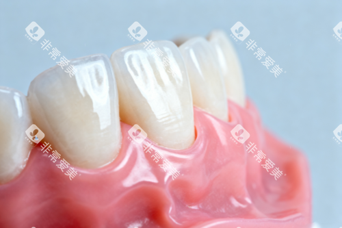 全瓷牙模型图