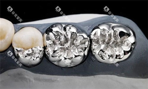 烤瓷牙素材图片