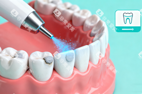 口腔清洁卡通展示图